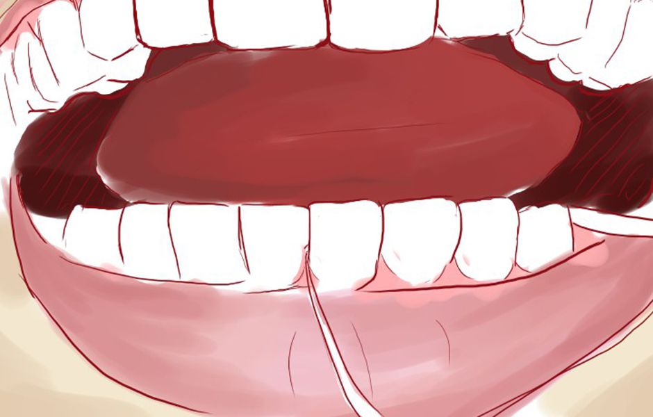 how to floss 35435345 compressed - چگونه نخ دندان بکشیم؟