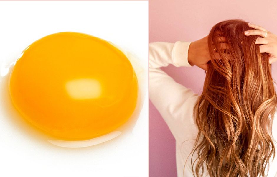 how to get rid of dry hair and dry scalp 454365656 - چگونه از شر مو و پوست سر خشک خلاص شویم؟