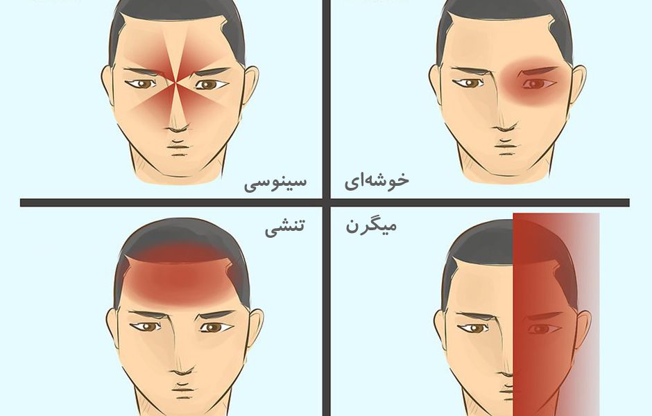 how to get rid of a headache 323434344 - چگونه سردرد را درمان کنیم؟