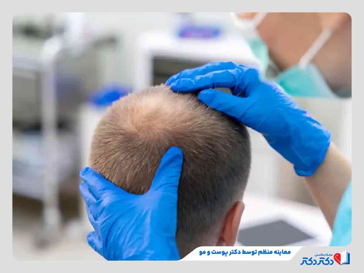 Examination by a doctor - ریزش مو سکه ای؛ 5 علت ریزش سکه ای مو و درمان فوری آنها