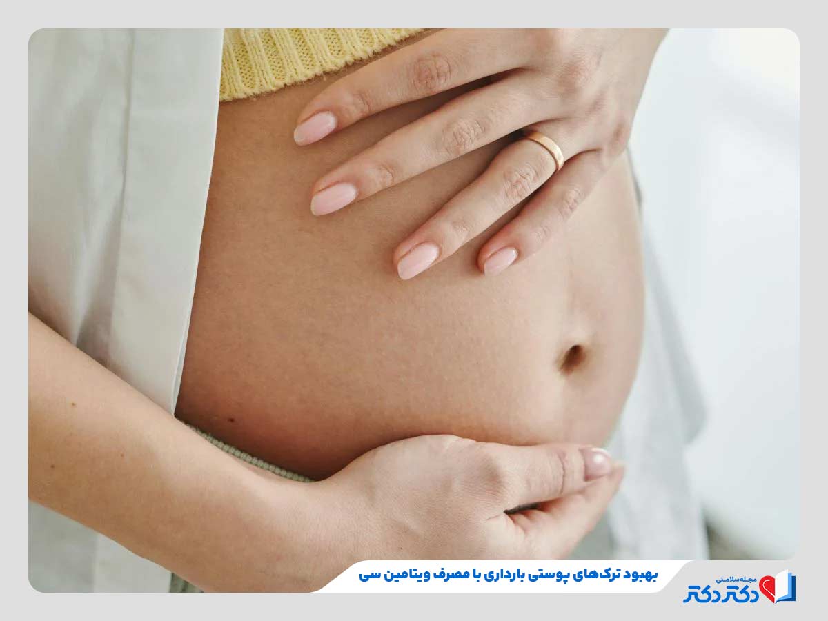 Improving skin elasticity during pregnancy - مصرف منابع و مکمل ویتامین C در بارداری