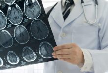 بعد از عمل برداشتن رحم چه باید کرد؟ Migraine and Brain Tumor 2 220x150 - بعد از عمل برداشتن رحم چه باید کرد؟