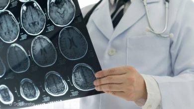 تفاوت میگرن و تومور مغزی، همه چیز را جامع و کامل بدانید Migraine and Brain Tumor 2 390x220 - تفاوت میگرن و تومور مغزی، همه چیز را جامع و کامل بدانید