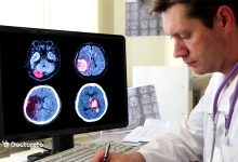 فیبروم رحم در دختر و هر آنچه باید درباره آن بدانید brain tumor 10 220x150 - فیبروم رحم در دختر و هر آنچه باید درباره آن بدانید