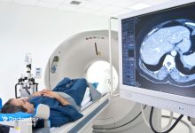 Benign Brain Tumor 1 220x150 - چه زمانی شربت برای تخلیه عفونت ریه موثر است؟