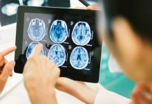 آیا امکان مشاهده علائم حاملگی در دوران یائسگی وجود دارد؟ Which part of the head is dangerous to hit 2 220x150 - آیا امکان مشاهده علائم حاملگی در دوران یائسگی وجود دارد؟