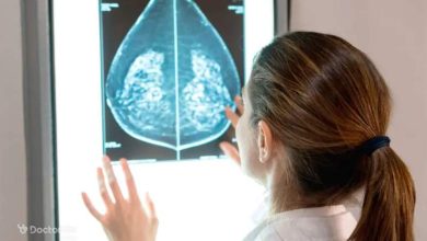 breast cancer 7 1 390x220 - بررسی کامل بیماری سرطان سینه گرید ۳