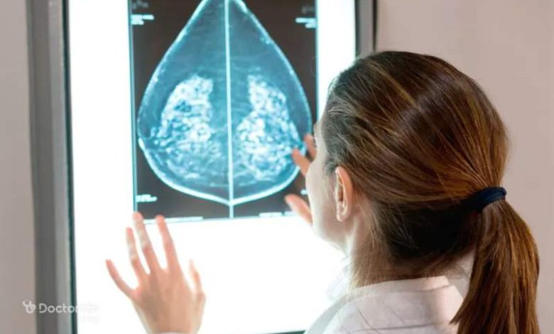 breast cancer 7 1 780x470 - بررسی کامل بیماری سرطان سینه گرید ۳