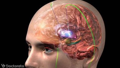 ldflkdzos1 1 390x220 - تحریک الکتریکی مغز با چه هدفی انجام می‌ شود؟