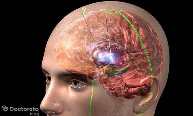 تحریک الکتریکی مغز با چه هدفی انجام می شود؟ ldflkdzos1 1 780x470 - تحریک الکتریکی مغز با چه هدفی انجام می شود؟