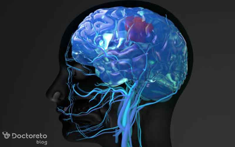 تحریک الکتریکی مغز با چه هدفی انجام می شود؟ ldflkdzos2 - تحریک الکتریکی مغز با چه هدفی انجام می شود؟