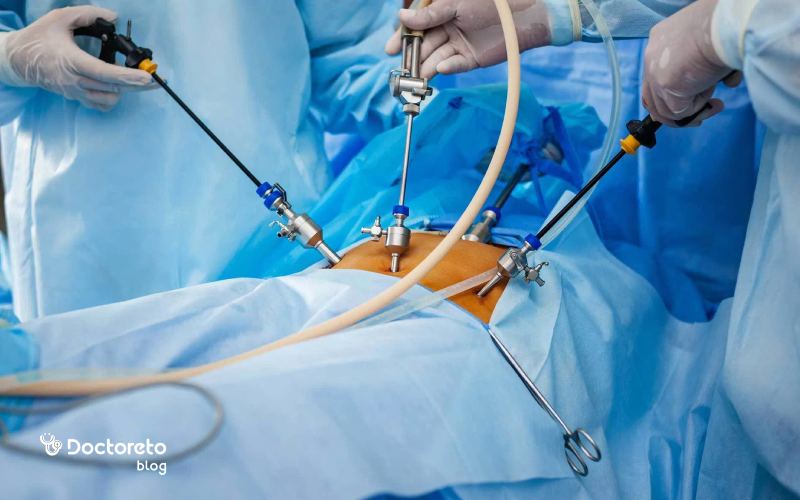 ovarian cyst treatment 1 - بررسی تمامی روش های درمان کیست تخمدان