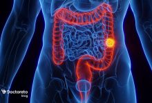 چگونه ده انگشتی تایپ کنیم؟ Bowel cancer 4 min 220x150 - چگونه ده انگشتی تایپ کنیم؟
