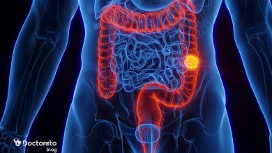 Bowel cancer 4 min 390x220 - عاقبت سرطان روده چیست؟