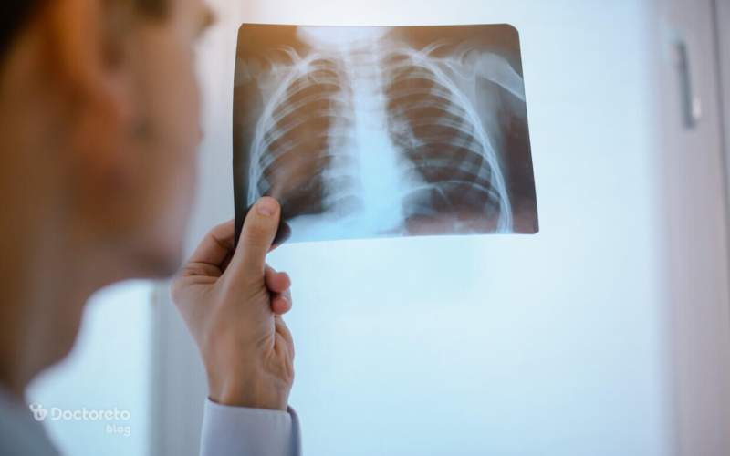 بهترین روش های پاکسازی ریه از عفونت چه هستند؟ Clearing the lungs of infection 2 1 - بهترین روش های پاکسازی ریه از عفونت چه هستند؟