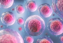 Umbilical Cord Blood 022 220x150 - ضربه به کدام قسمت سر خطرناکه؟