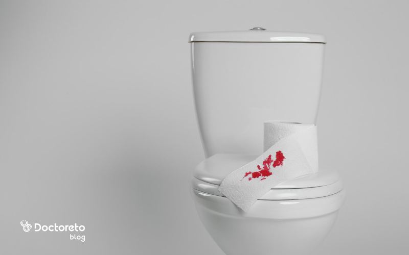 fissure colon cancer difference - بررسی تفاوت شقاق و سرطان روده