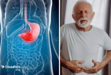 gastric cancer 4 220x150 - بازگشت دیزنی به بازیگران سفیدپوست؛ احتمال حضور اسکارلت جوهانسون در &laquo;گیسوکمند&raquo;