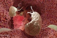 odkjkdxzk1 220x150 - علائم کبد چرب در بارداری؛ بررسی تخصصی نشانه ها و هشدارها