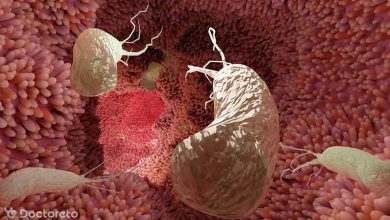 odkjkdxzk1 390x220 - همه‌ چیز درباره سرطان معده خوش خیم