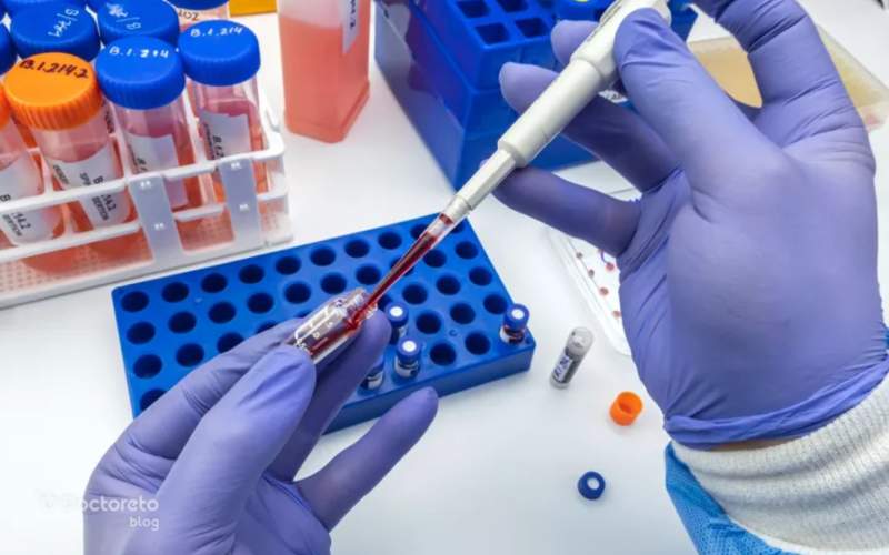 signs of colon cancer in blood tests 2 - علائم سرطان روده در آزمایش خون چیست؟