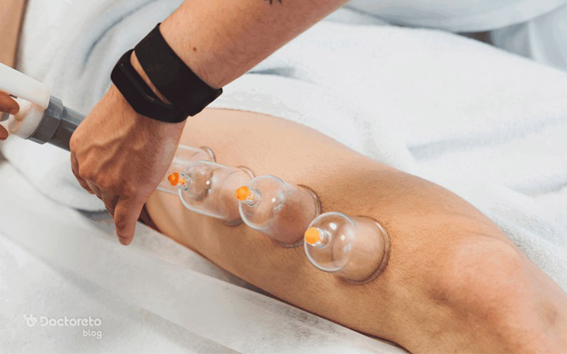 benefits cupping 1 - فواید حجامت چیست؟ بررسی خواص احتمالی با شواهد علمی