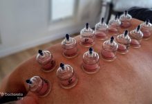 benefits cupping 3 220x150 - بررسی تفاوت شقاق و سرطان روده