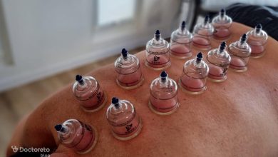 benefits cupping 3 390x220 - فواید حجامت چیست؟ بررسی خواص احتمالی با شواهد علمی