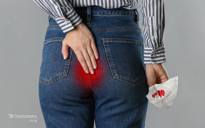 علت بواسیر در زنان چیست و چگونه باید درمان شود؟ causes hemorrhoids women 2 - علت بواسیر در زنان چیست و چگونه باید درمان شود؟