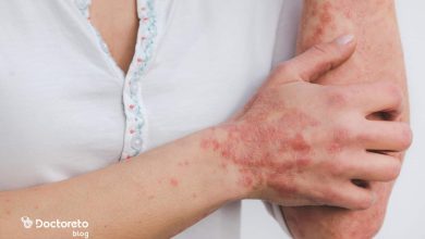 dermatitis 390x220 - بررسی تمامی علل حساسیت پوستی خارش و قرمزی