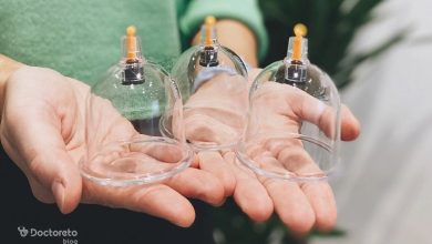 who should cupping 3 390x220 - چه کسانی باید حجامت کنند و چه کسانی باید احتیاط کنند؟