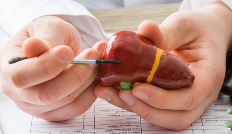 Grade 2 fatty liver 3 e1653307059783 780x450 - کبد چرب گرید ۲: علائم، علت، تشخیص و درمان کبد چرب گرید ۲