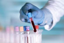 fatty liver test 2 220x150 - آزمایش کبد چرب: انواع، نحوه انجام و تفسیر نتایج