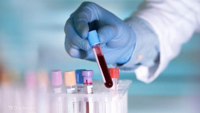آزمایش کبد چرب: انواع، نحوه انجام و تفسیر نتایج fatty liver test 2 390x220 - آزمایش کبد چرب: انواع، نحوه انجام و تفسیر نتایج